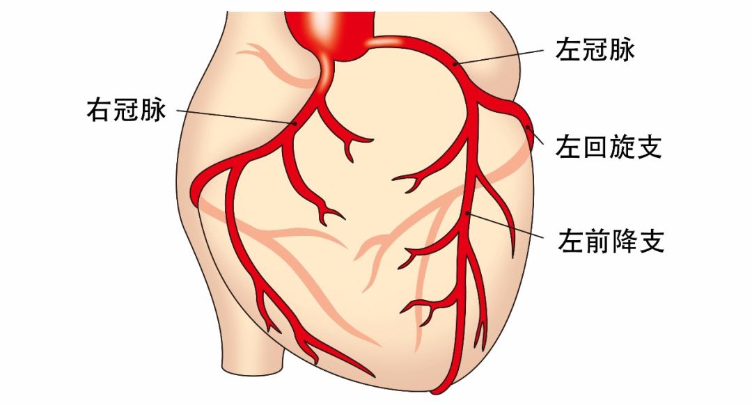 冠状动脉分左右两支,即左冠状动脉与右冠状动脉.