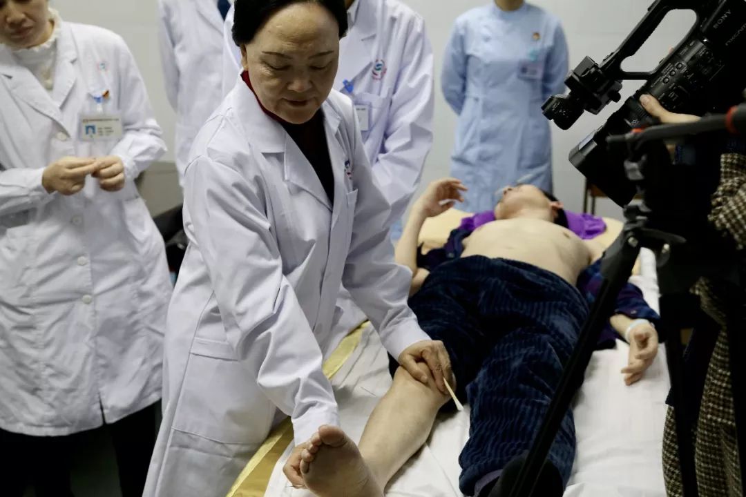 卞金玲教授为脑出血恢复期患者进行针刺治疗