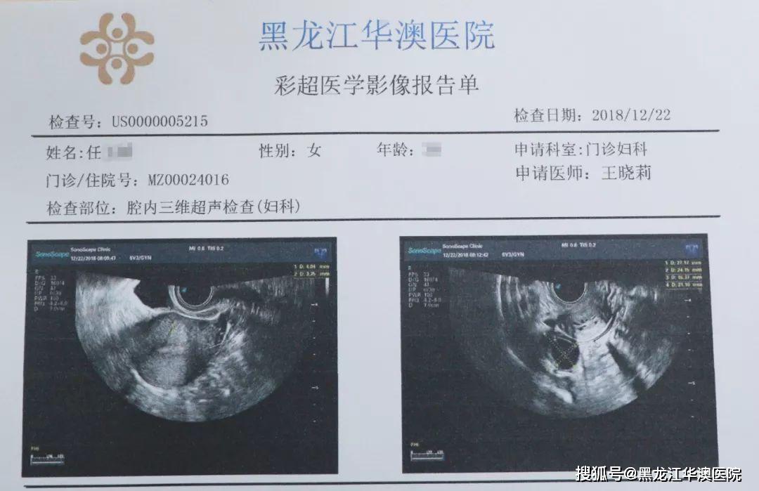 孕妇突发大出血,华澳医院妇科团队紧急施救力挽狂澜!