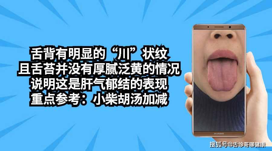 抖音舌诊哥舌象分析与感悟:气虚体质,疲劳乏力,孤独,无助