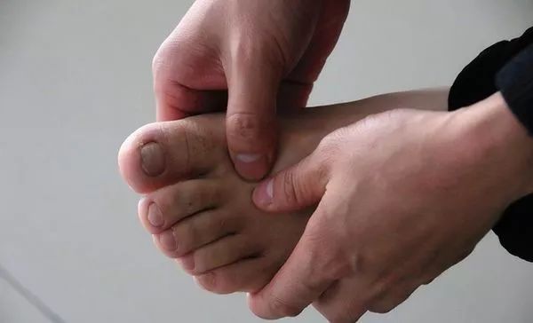 什么是水肿什么是积水 90f71e9823d64397afe074cade0acb9d.jpeg