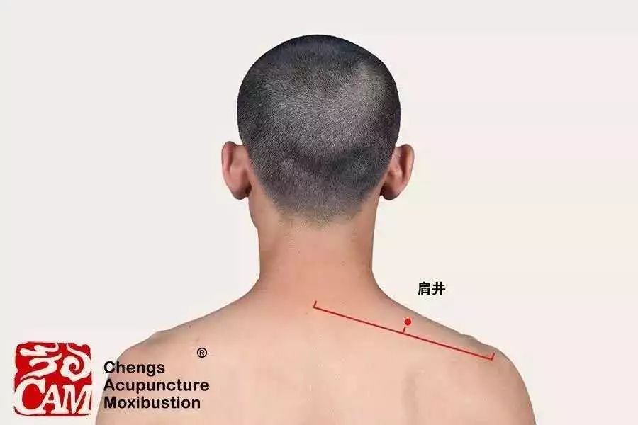 医师分享颈肩腕综合征的形成原因及中医治疗方法