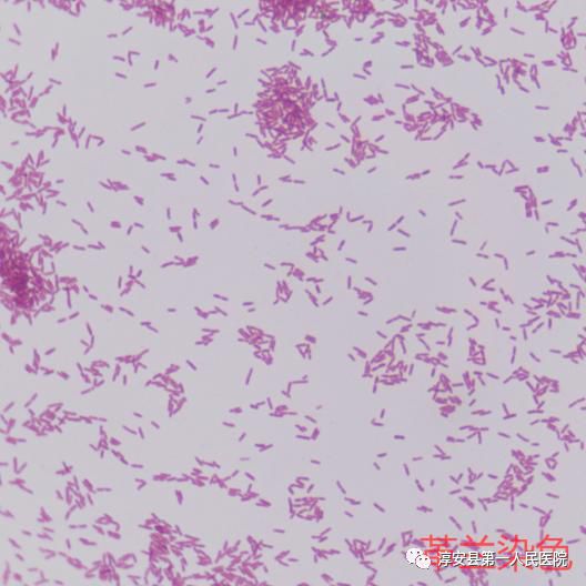 追踪痰中最常见的"杀手"之一——铜绿假单胞菌