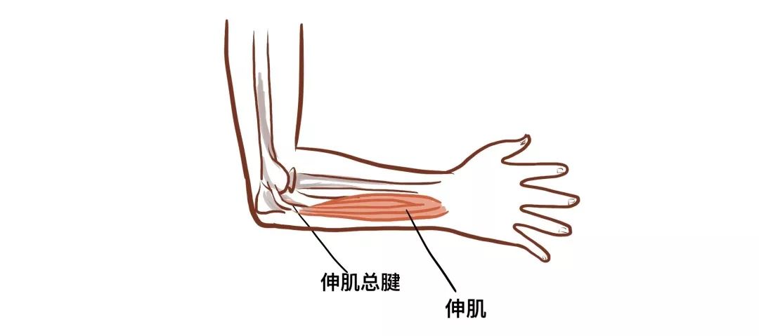 运动医学专家谈打网球才会得网球肘