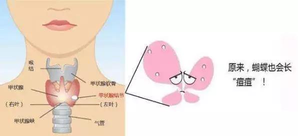 大庆市甲状腺癌占人口的多少_大庆市地图(3)