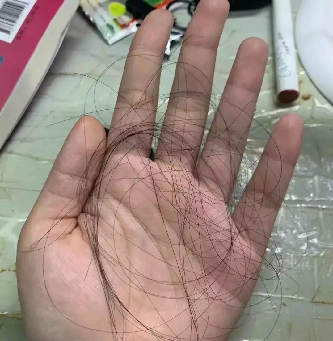 身上发黄是什么病症 743b3ff2160e4e1592512510e18619fd.jpeg