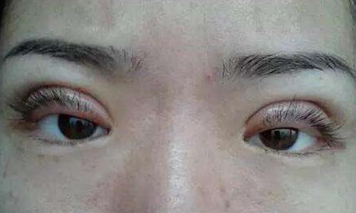 眼睛模糊吃什么药恢复 c2c9fc0443ca43a29b2ac33fb24f49d1.jpeg