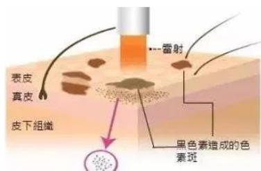 什么时候提出激光原理_激光切割机原理结构图