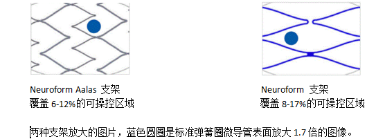 jnis中文版丨蒯东教授导读:neuroform aalas支架系统在颅内动脉瘤中的