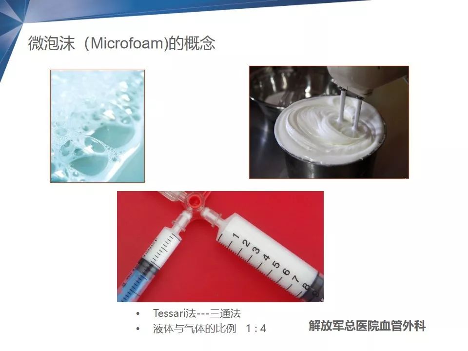 教学ppt | 泡沫硬化剂及其在静脉疾病中的临床应用