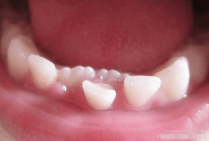 c208a30517f342c584696455c0b1d94a.png