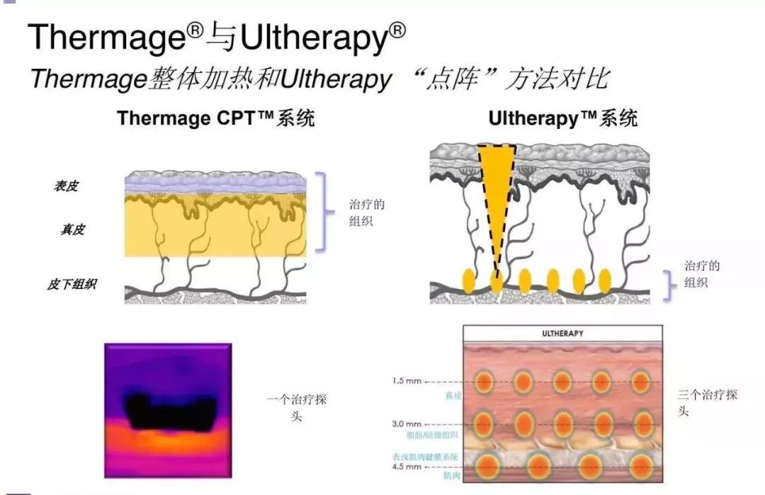 速尿的作用原理_汽车点火系统电路图及工作原理