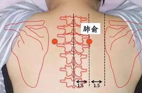 三伏天贴哪里最好 28fd2f6858b647fca79d5f29c5fcd475.jpeg