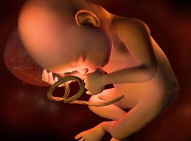 胎儿肾分离是什么意思