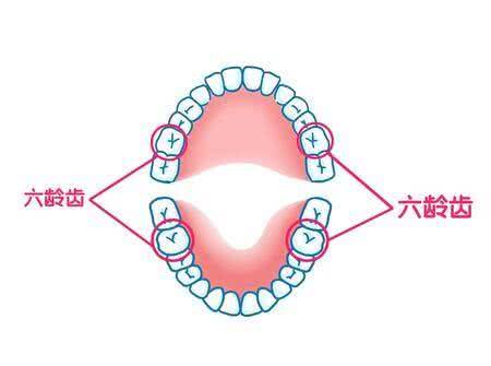 深圳男童差点丢失"六龄牙,父母认知很重要:六龄牙不是乳牙!