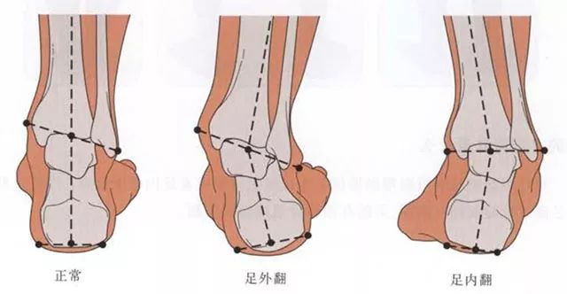 双侧搭肩试验怎么做_教师节贺卡怎么做