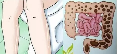 如何把肚子宿便排空干净 c8966b0e0c594eacbf30d941cdbcf706.jpeg