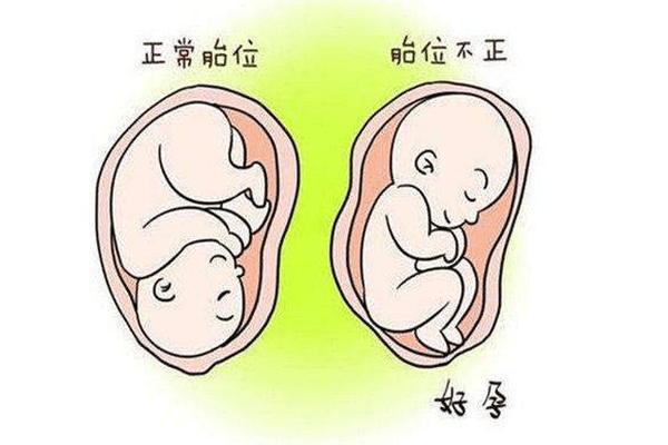 几个月才能知道胎位正不正呢