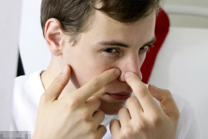 鼻子上源源不断的黑点到底是什么?该拿它们怎