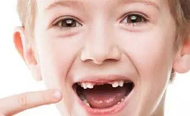 孩子乳牙储存起来，能救命？是有条件的，家长别交智商税