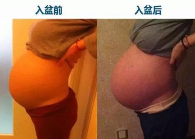 孕晚期，胎宝头朝下难受吗？你可能不知道，为了见你宝宝有多努力