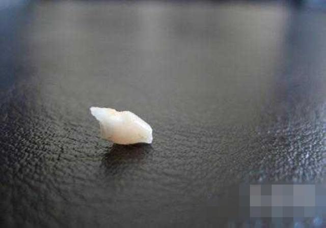 趣儿养母■原创孩子乳牙储存起来，能救命？是有条件的，家长别交智商税