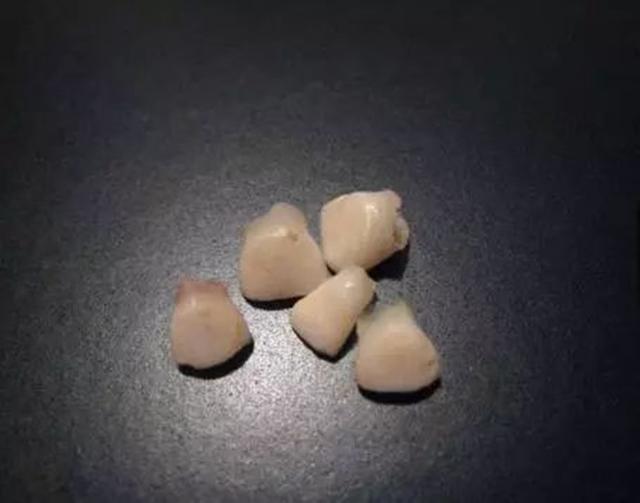 趣儿养母■原创孩子乳牙储存起来，能救命？是有条件的，家长别交智商税