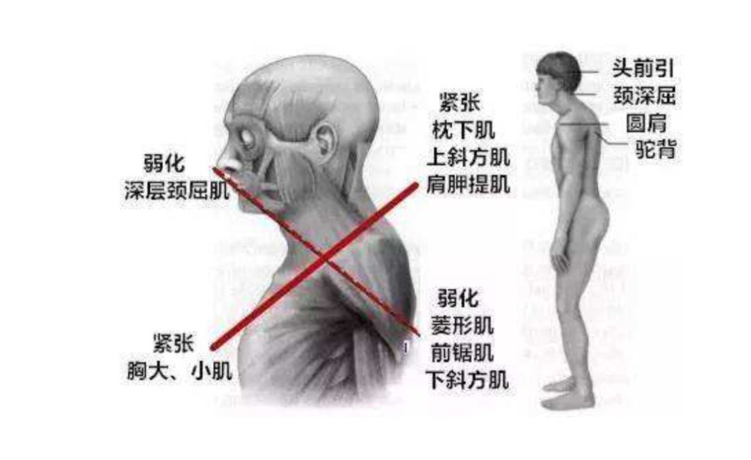 长姿势#体态不对,健身等于是白费