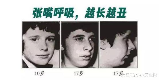 #成长樹#原创当心这个坏习惯，让孩子越长越丑