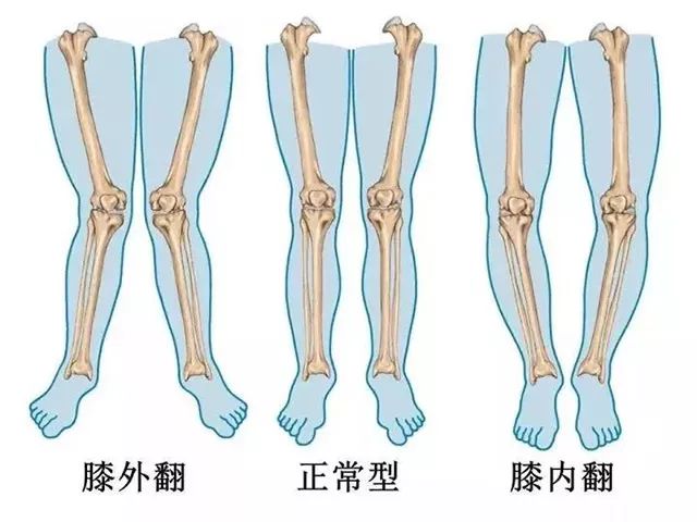 0-6岁宝宝的腿不是越直越好,原因竟是因为