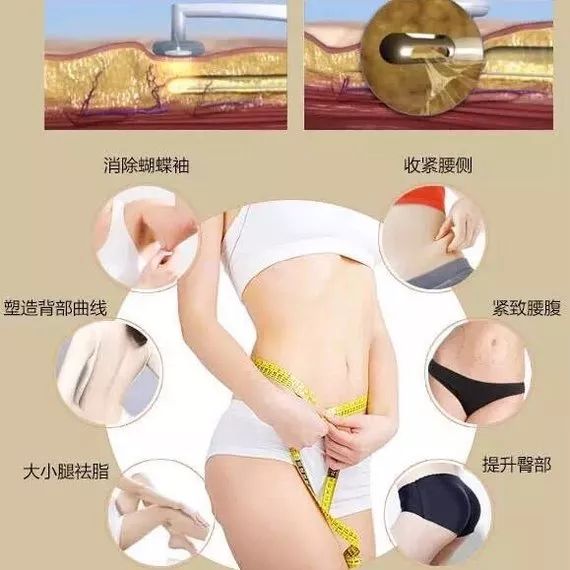 黄金微雕的原理是什么_黄金微雕是什么仪器(2)