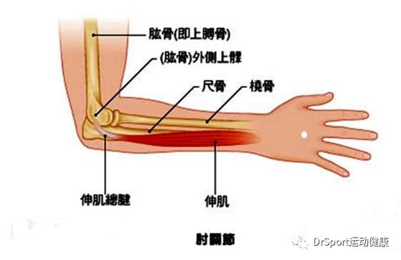 大家所熟知的网球肘,在医学上叫做肱骨外上髁炎:是肘关节外侧前臂伸肌