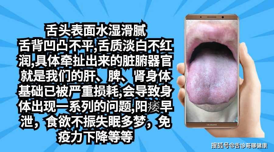 抖音舌诊哥舌象感悟:气虚体质,关节疼痛,神经质