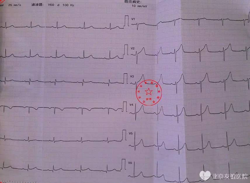 什么叫特殊类型的综合症 1781f5d2b70048e7acdc64dbc49b3cec.jpeg