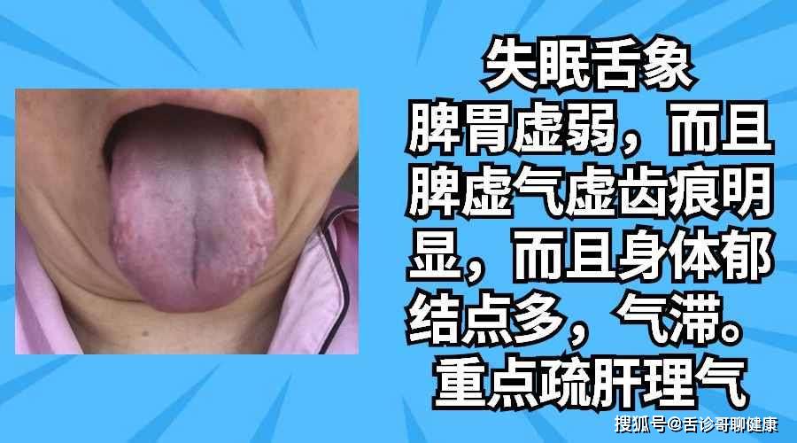 抖音舌诊哥舌象感悟:湿热体质,气短,虚汗,恐惧不安