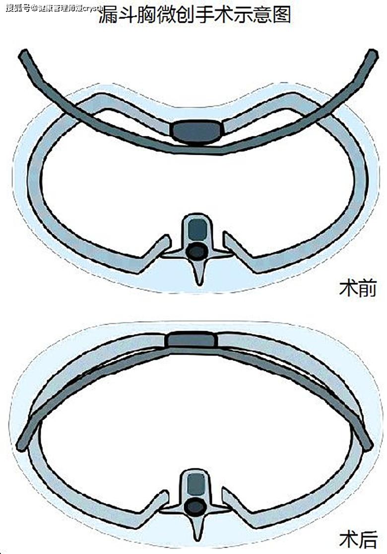 健康管理师媛crystal：宝宝睡软床好还是硬床好？哪种可以让宝宝健康发育成长呢？