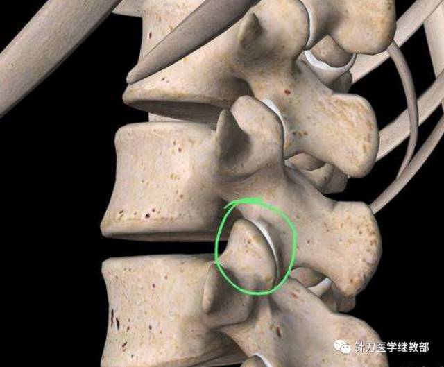 容易被忽视的腰痛原因——腰椎关节突源性腰痛