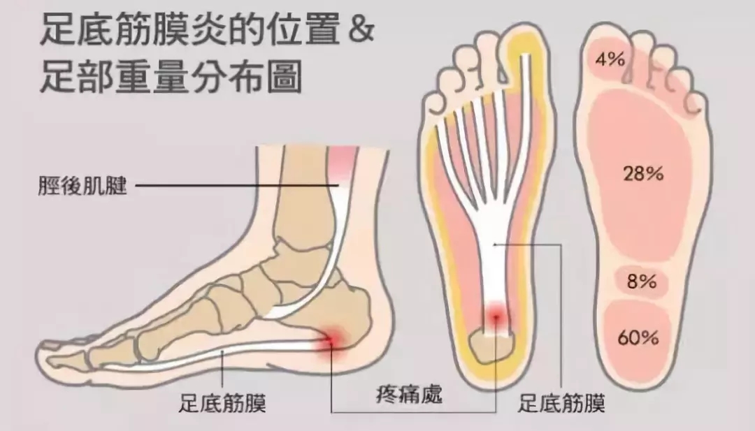 走路脚疼怎么办