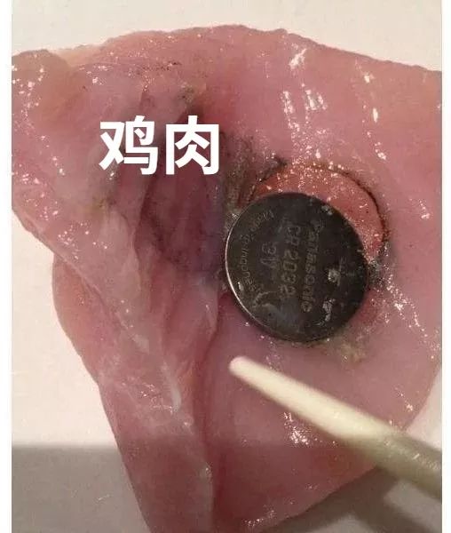 #930老友记#家长注意！纽扣电池成杀手，广西女童险因此丧命...