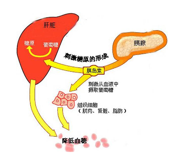 三个原因引起糖尿病出现这四个症状马上修复胰岛细胞还来得及