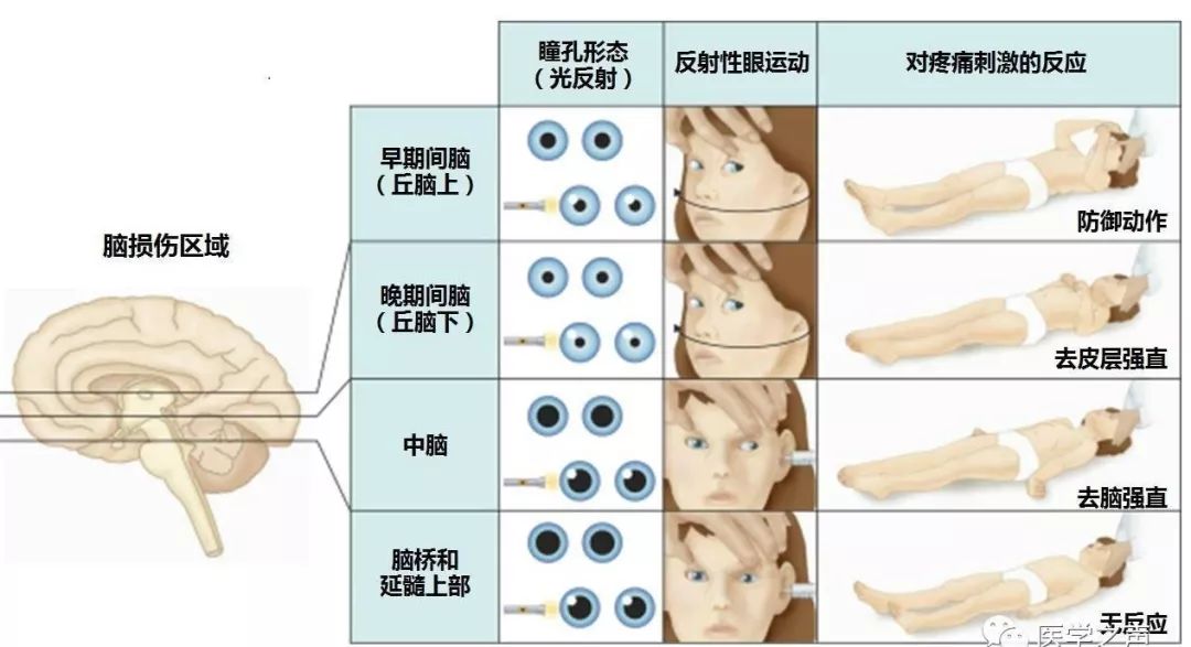 GDP是什么神经系统瘤_白带是什么图片