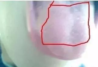 这样喝水,迟早要摊上大事!越喝越胖,越喝湿气越重…太可怕了
