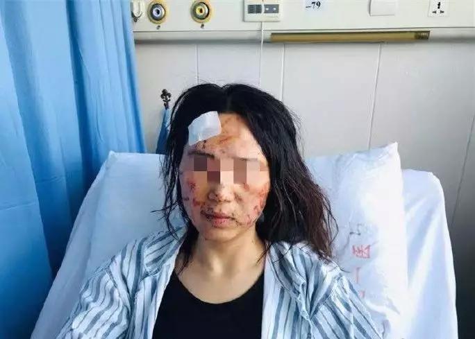 女子遭公公及丈夫当街殴打泼粪，警方介入妇联发声