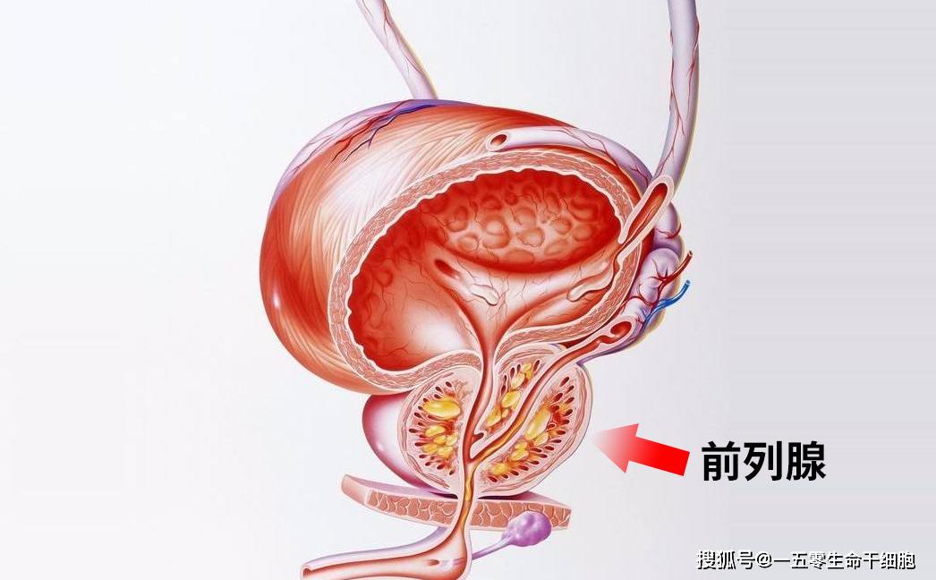 警惕前列腺炎的3大症状与危害,干细胞疗法祝您解决"男