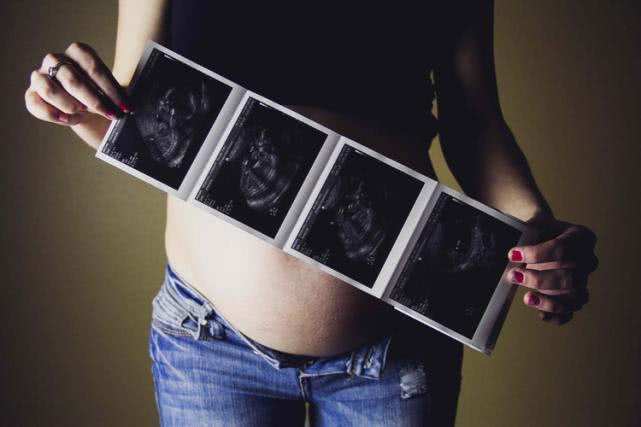 整个孕期做几次B超、每次检查时间及检查内容，孕妈收藏