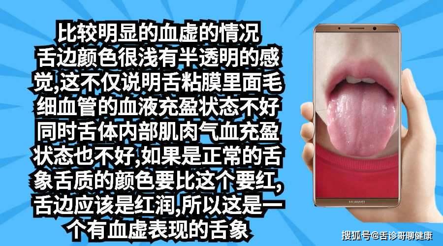 抖音舌诊哥舌象感悟:血瘀体质,气短,虚汗,孤独,无助