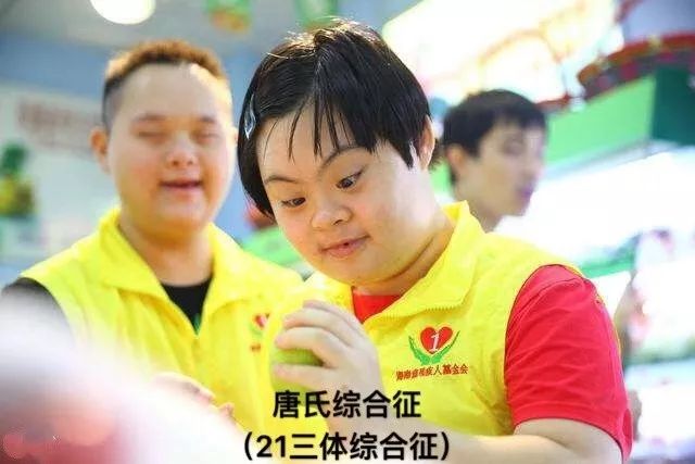 征,t18染色体异常(爱德华氏综合征)和t13染色体异常(帕陶氏综合征)