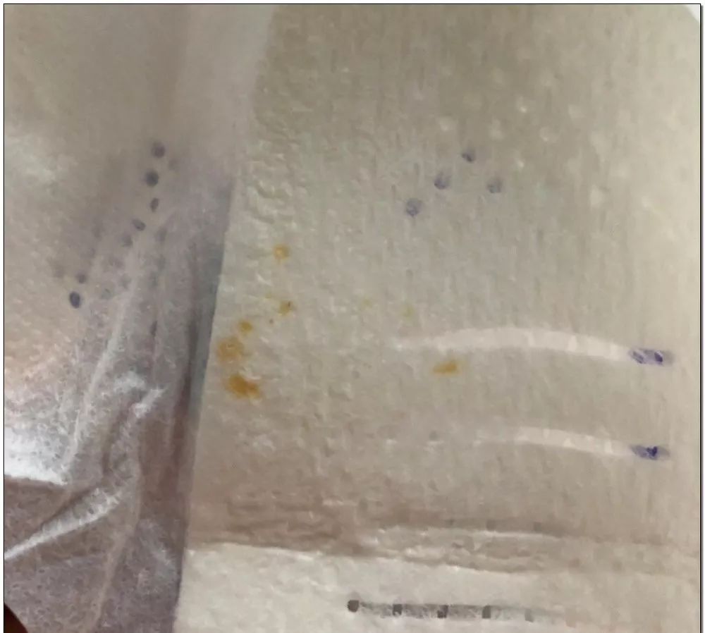 呕大牌卫生巾竟然都是虫卵万一孵化了在体内长蛆发抖