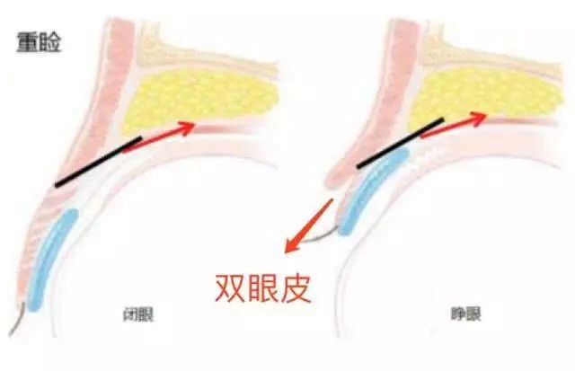 哪儿出了问题_眼睑