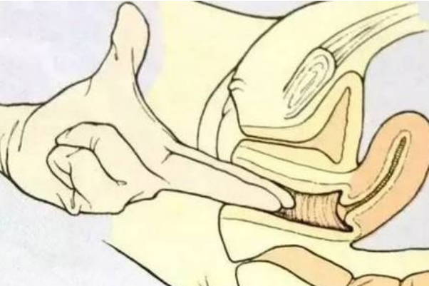 内检时，手指要伸进去多少？一起来看看过来人的经历